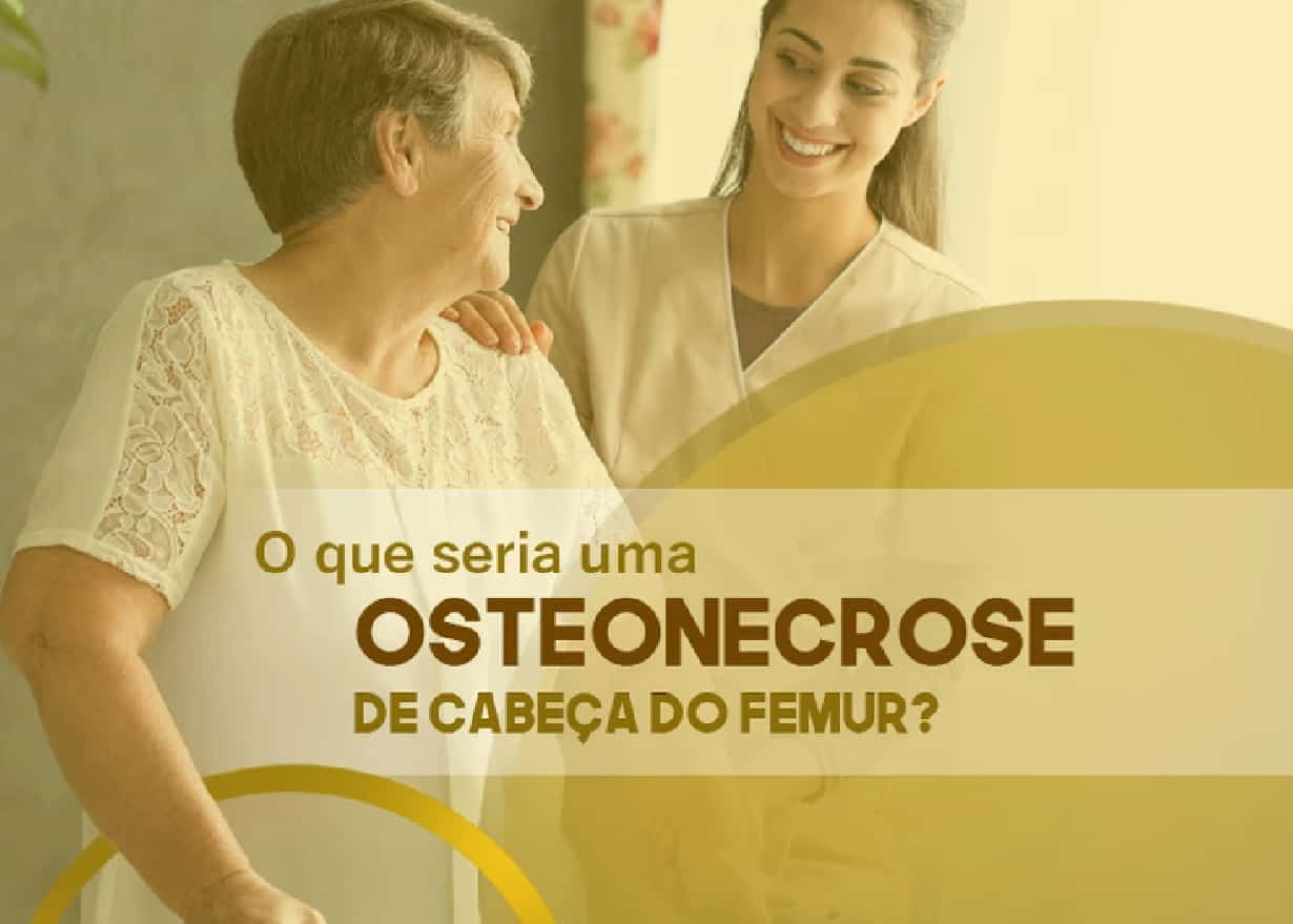 Read more about the article O que seria uma Osteonecrose de cabeça do femur?
